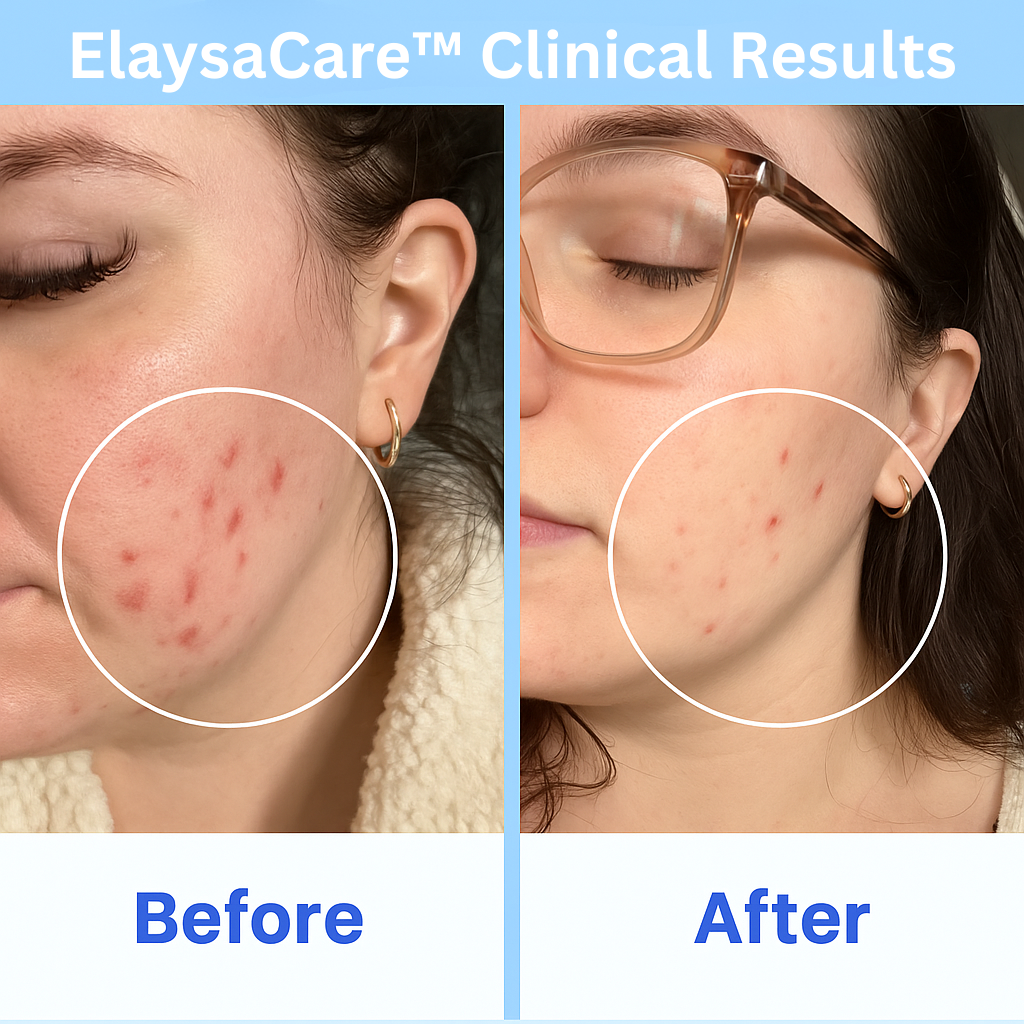 ElaysaCare™ Radiance Wand