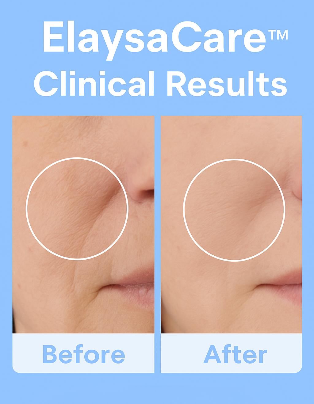 ElaysaCare™ Radiance Wand