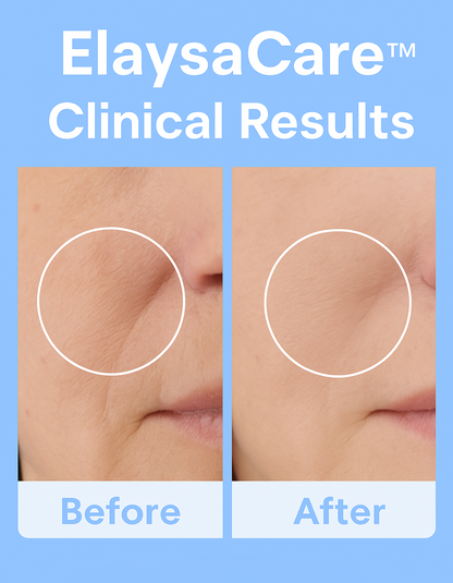 ElaysaCare™ Radiance Wand
